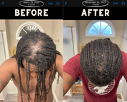 Herbal Hair Oil