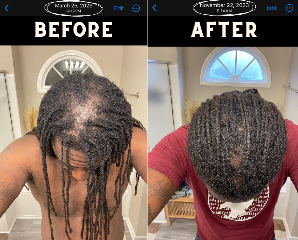 Herbal Hair Oil